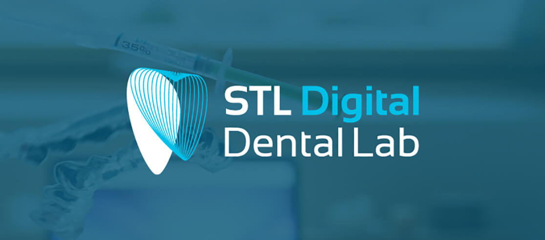 STL digital Dental Lab Creative Logo Design